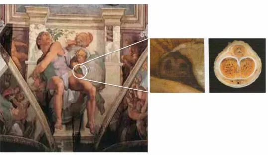 Figure 1 - The Figure of the Prophet Jonah on the ceiling of Sistine Chapel, by Michelangelo Buonarroti, highlighting a detail of  the scene of the prophet Jonah and his correlation to a design of a cross section of the base of a penis, with the two cavern