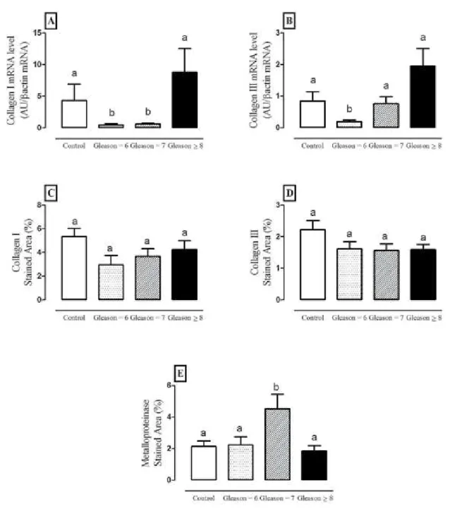 Figure 9 - Gene expression of Collagen I (A) and III (B) in the benign areas of cystoprostatectomy tissues and benign prostatic  tissues adjacent to the tumor area in Gleason score=6 , 7,  ≥  8