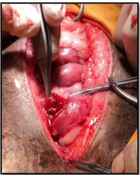 Figura 3 – Carcinoma urotelial papilífero de grau 3 em canídeo. CVVC.  