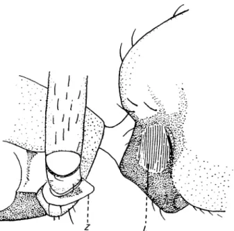 Figure 8 Lepthyphantes ? schmitzi Kulczynski, 1899, Female, epigyne, ventral (a) posterior (b) and lateral aspect (c);