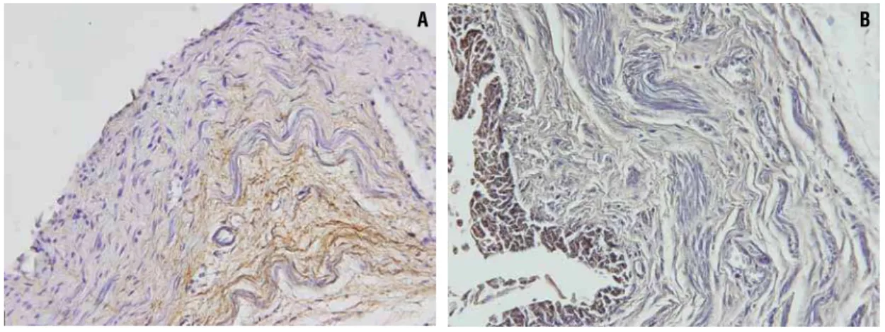 Figure 2 - Photomicrographs showing the elastic system fibers (Brown). A) Normal fetal ureter with 27 WPC