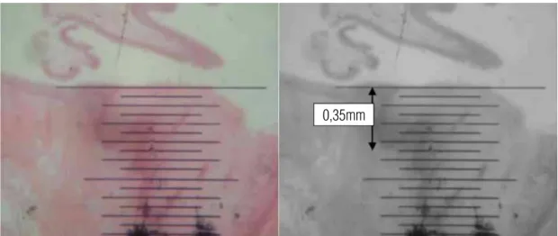 Figure 5 - Microscopic ruler measuring the epithelial thickness on non-keratinized group within 8 weeks