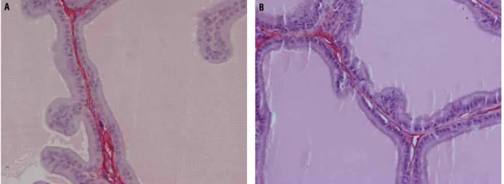 Figure 5 - Photomicrographs showing prostate collagen of rat groups. A) Ventral prostate lobe of group T65