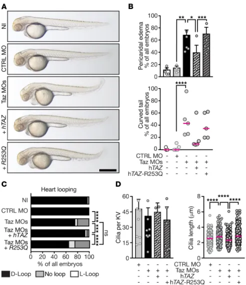 Figure 6. Patient rare variants cannot rescue  ciliopathy-like phenotype. (A) Representative  images of 48 hpf zebrafish embryos, which  were either noninjected (NI), control-injected  (CTRL MO), or injected with MOs targeting Taz  (Taz MOs), respectively