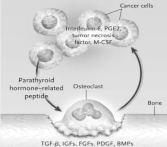 Figure  12. The  Vicious  Cycle  of  Osteolytic  Metastasis.  Breast-cancer cells, secrete  PTHrP as  the  primary  stimulator  of  osteoclastogenesis
