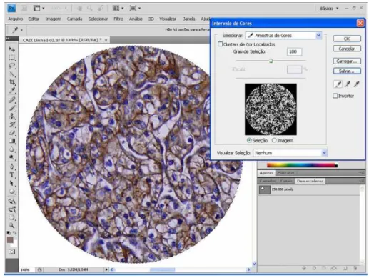 Figure 1 - Region of Interest (ROI), and selection of brown color of interest using the color selection tool.