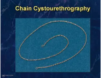 Figure 1 - Demonstrates the 14kt gold (rhodium-plated) link  chain measuring 60mm in length and 2.15mm in width; it  weighs approximately 7.40 grams and has one round link on  each end; the end links have an outside diameter of 5.00 mm  and an inside diame