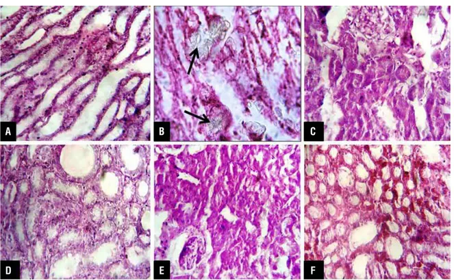Figure 1 - Histopathological images of kidney sections after H&amp;E staining under light microscope (X 40) (A) Vehicle control  group, (B) EG control group showing calcium oxalate crystals (arrows in figure), (C to F) Cow urine ark treated groups.