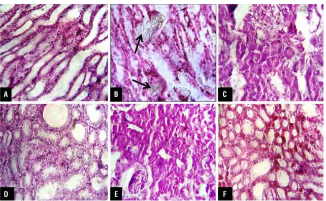 Figure 1 - Histopathological images of kidney sections after H&amp;E staining under light microscope (X 40) (A) Vehicle control  group, (B) EG control group showing calcium oxalate crystals (arrows in figure), (C to F) Cow urine ark treated groups.