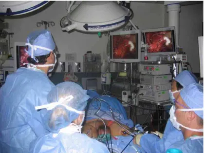 Figure 1 - Simultaneous bilateral VEIL.