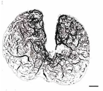 Figure 8 - Area of the corpus cavernosum sinuses of rabbits  from the diabetic group. Binarized image taken at 40x  mag-nification