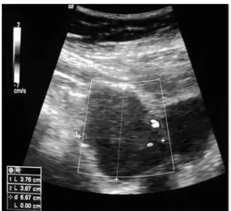 Figure 1 - Abdominal Ultrasound.
