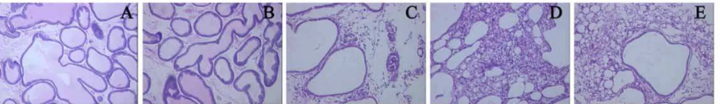 Figure 1 - Pathological changes of the prostate in different groups. In the control group (A) and inflammation 0 day group (B),  the mucosal epithelium maintained an orderly organization, without leukocyte infiltration in interstitial tissues