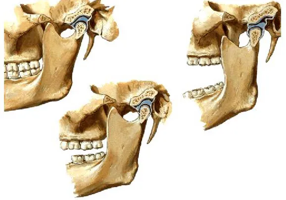 Figura 1: Articulação temporomandibular. Adaptado de(Netter &amp; Hansen, 2003). 