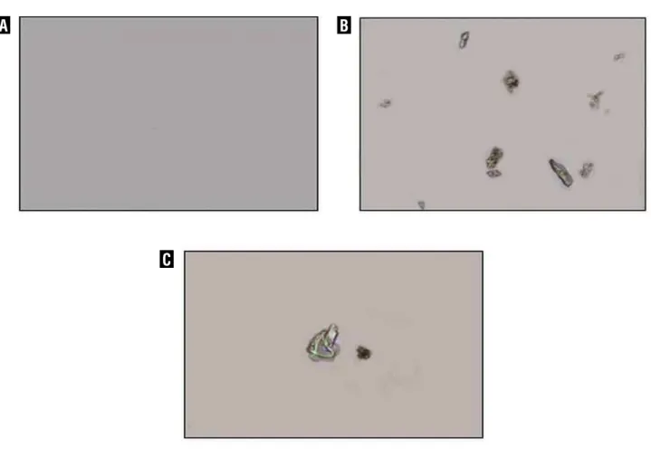 Figure 4 - Polarization micrograph of rat’s urine sample. 