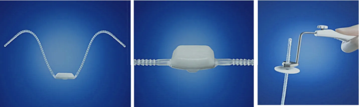 Figure 1 - ARGUS T adjustable system – Promedon SA.