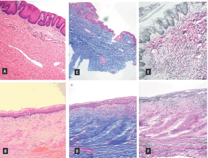 Figure 2 - Histopathological examination of the normal tunica albuginea (A, C, and E) and repaired area (B, D, and F)