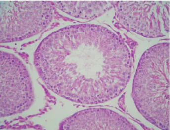 Figure 2b - Spermatogonia, spermatocytes and many early  spermatids are seen. No late spermatids and spermatozoa  are present (H-E, x400).