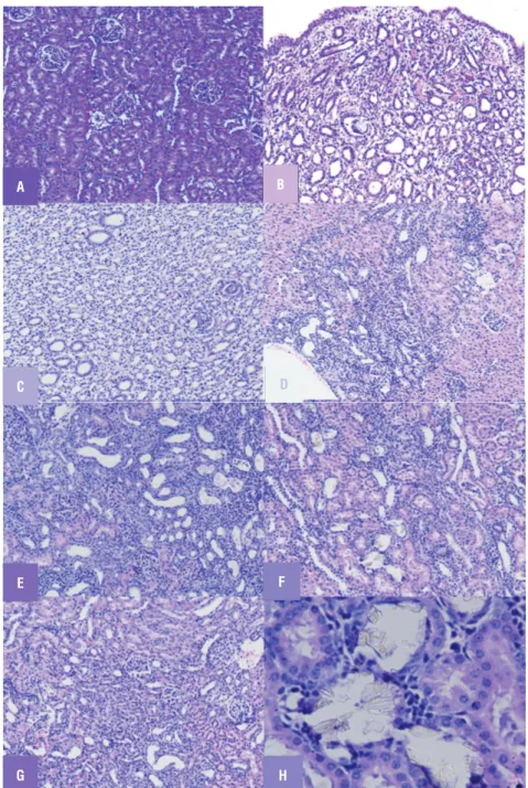 Figure 1 - Light microscopic architecture of kidney showing (A) Renal tissue of control (group 1) rats showing no sign  of crystal deposition