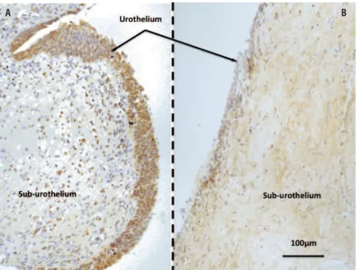 Figure 1 - Microscopic features of Sphingosine Kinase 1 expression.
