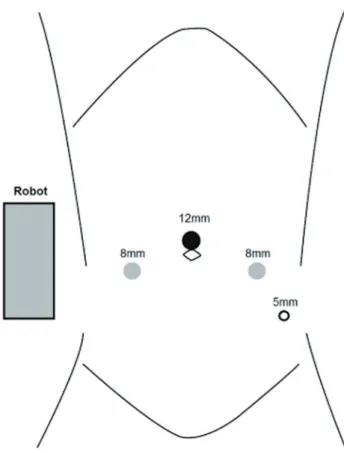 Figure 1 - daVinci robotic Si surgical platform port placement.