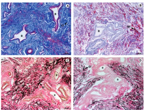 Figure 2 - Photomicrograph of native tissue (A and C), and decellularized matrix of human glans (B and D)