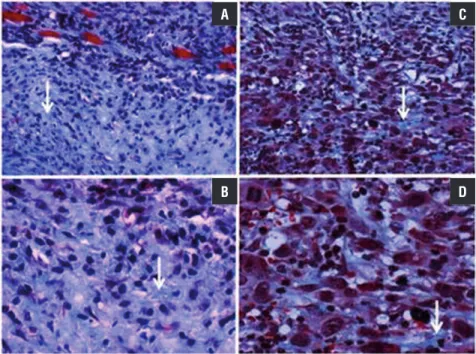 Figure 1 - Histological slices representative of PC-3 prostatic tumors stained with Masson´s trichrome