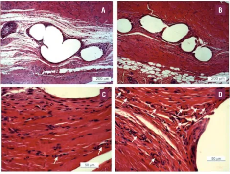 Figure 1 - Composite Mesh: PVA/GSNO-40-impregnated PP mesh. Representative micrograph of the subcutaneous tissue  surrounding filaments of PP meshes 21 days after implantation in the subcutaneous tissue of Wistar rats