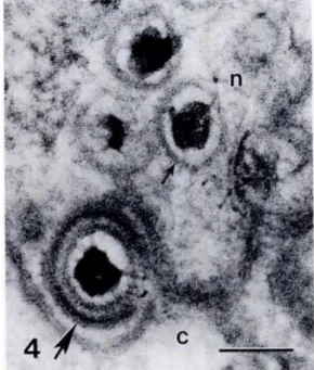 Figura 10 – Imagens de microscopia eletrónica de transmissão de uma célula epitelial de baleia-branca  (Delphinapterus leucas) infetadas por herpesvirus: 3) “viriões” sem envelope no interior do núcleo (n) e com 