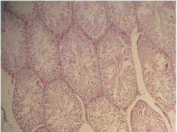 Figure 1 - Light microscopic view of testis tissues from  IR group showing coagulative necrosis with loss of  seminiferous tubule epithelium, edema and sloughed  germinal cells