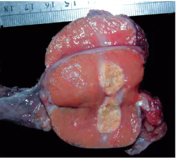 Figure 1 - Macroscopic cut section appearance of testicular calculus.