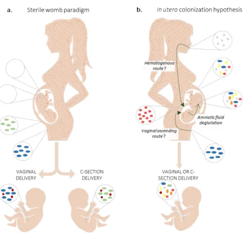 Figure 3 - Microbiota colonization of infants – two different hypothesis. a. Sterile womb paradigm defends that placenta and  fetus are sterile and that gut microbiota is acquired during and after birth