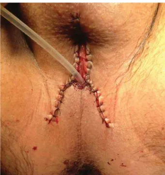 Figure 2 - Post-surgical appearance.