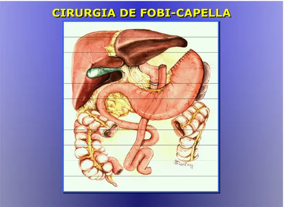 FIGURA 1 - Cirurgia de Fobi Capella 