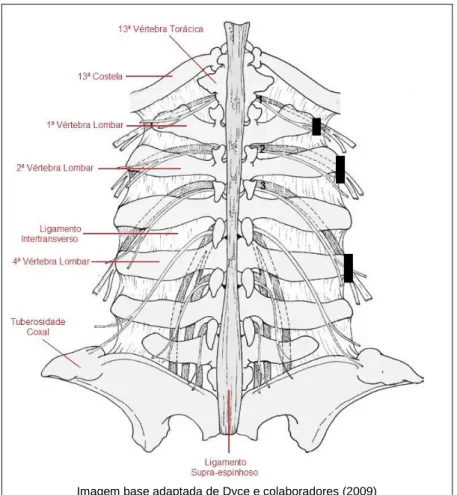 Figura 7 – Representação esquemática dos pontos de administração (retângulos negros) no bloqueio  paravertebral distal, em que a agulha direciona-se paralelamente às apófises transversas (Turner &amp; 