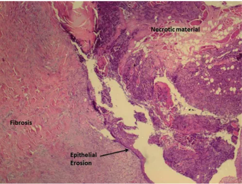 Figure 2 - Histological aspect of the reconstructed urethra in which dorsal component consisted of a transitional urothelium  and ventral component of a stratified scamous epithelium (group 8 weeks, HE x 40).