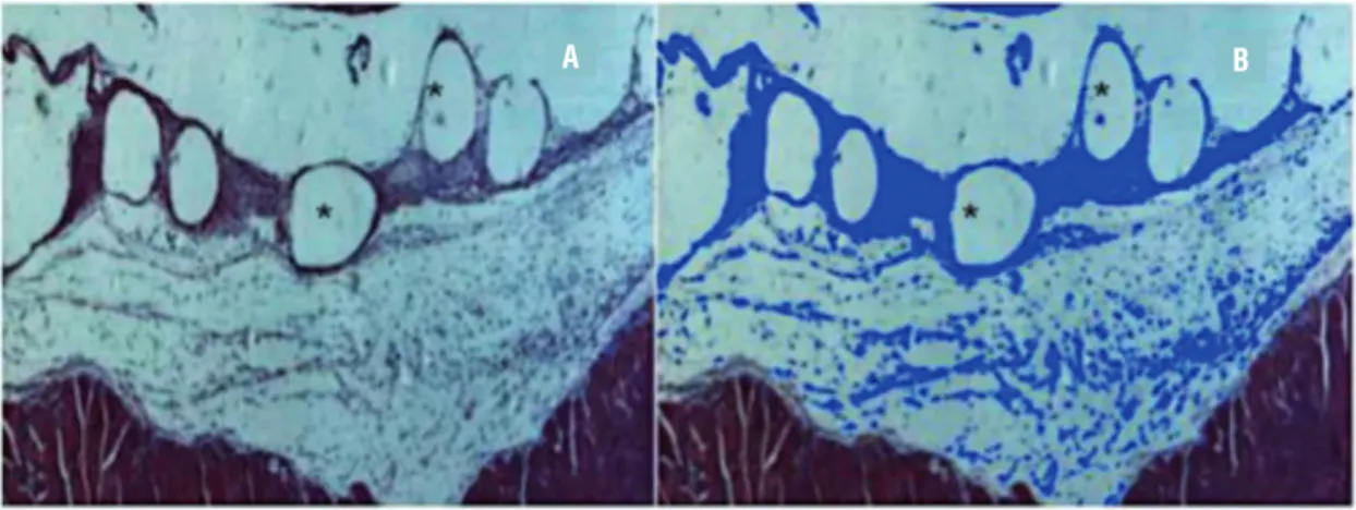 Figure 2 - Evaluation of collagen fibers birefringence in polarization microscopy. (A) The collagen fibers bright on the dark  background
