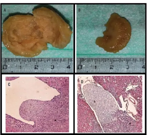 Figure 1 - a) Macroscopic view of kidney tissue of experimental group; b) Macroscopic view of kidney tissue of control  group; c) Hematoxilin and eosin (H&amp;E) stained histopathological images of kidney tissue of experimental group; renal pelvis  dilatat