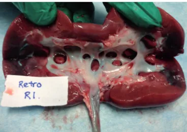 Figure 1 - Representative image after retrograde dye delivery with ureteral catheter.