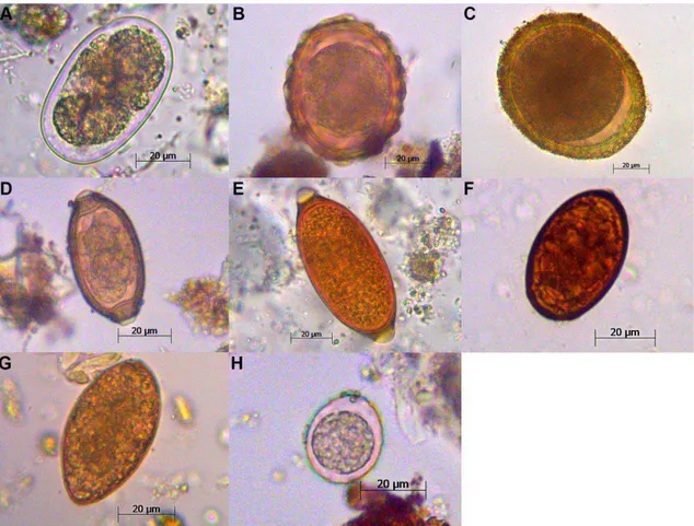 Figura  3:  Imagens  de  microscopia  (400x)  de  ovos  e  oocisto  de  enteroparasitos  encontrados 
