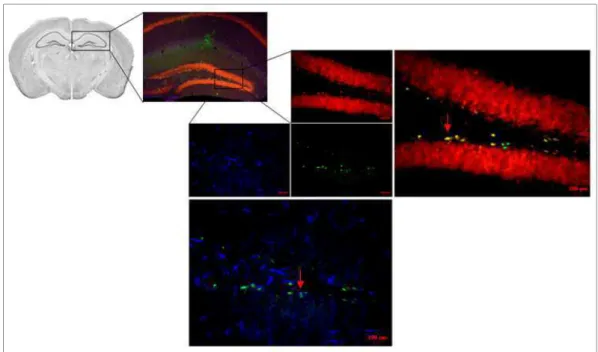 Figura  9:  I MAGEM  REPRESENTATIVA  DO  PROCEDIMENTO  DE  IMUNOFLUORESCÊNCIA  COM  DUPLA  MARCAÇÃO –  Fatia de hipocampo (giro denteado) dos animais  mostrando células (aumento de 40x) BrdU+  (verde),  GFAP  (azul  escuro)  e  Neu+  (vermelho)