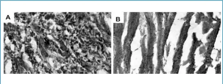 Figure 4 – Heart tissue histopathological characteristics of mice with acute Chagas disease treated or not with nifurtimox and dipyridamole
