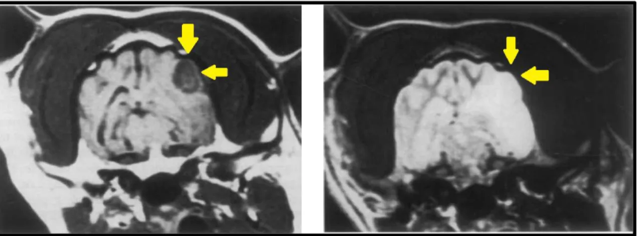 Figura 4. RM de um caso de meningioma em cão (setas amarelas). À esquerda temos uma  imagem em T1 e à direita em T2, ambas em corte transversal