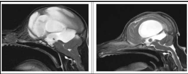 Figura 6. RM de dois casos diferentes de hidrocefalia em cães, numa projeção T2 em corte  sagital