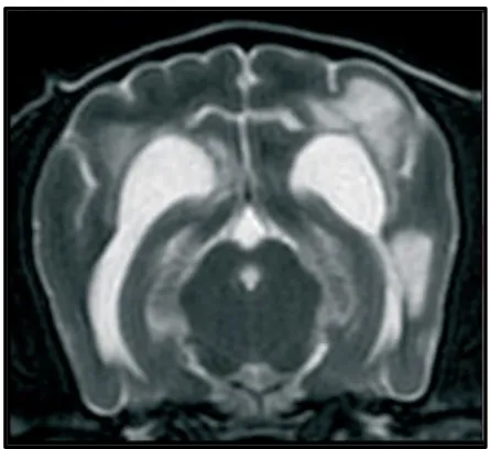 Figura 8. RM de um cão com uma forma multifocal de meningoencefalomielite granulomatosa,  em T2 num corte transversal, ao nível do mesencéfalo e hemisférios cerebrais