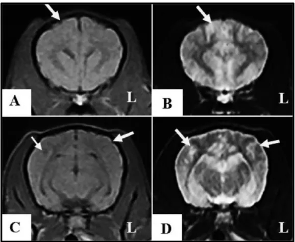 Figura 12. RM de um cão diagnosticado com meningoencefalite necrosante. A, C: corte sagital  em T1