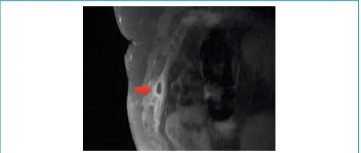 Figure 1 – T1-weighted image of MRI sagittal section with post-contrast fat saturation