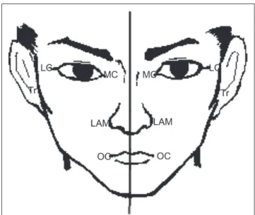 Figure 1. Representation of the landmarks of the facial anthropometric measurements.
