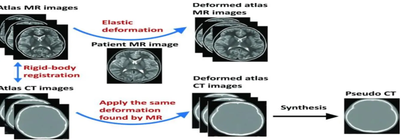 Figure 2.6 – Workflow of an atlas-based approach to generate a pseudo-CT [64]. 