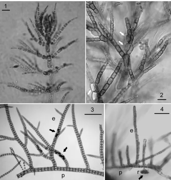 Fig. 1. 1.1) Antithamnionella boergesenii, habit showing branching and 1.2) lateral gland cells (scale bars= 
